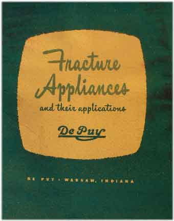 Fracture Appliances and their applications